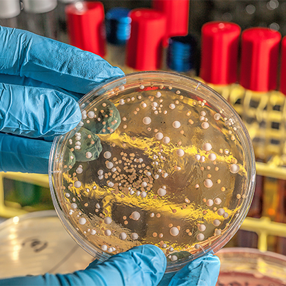 Kontrola zdravlja i bolesti